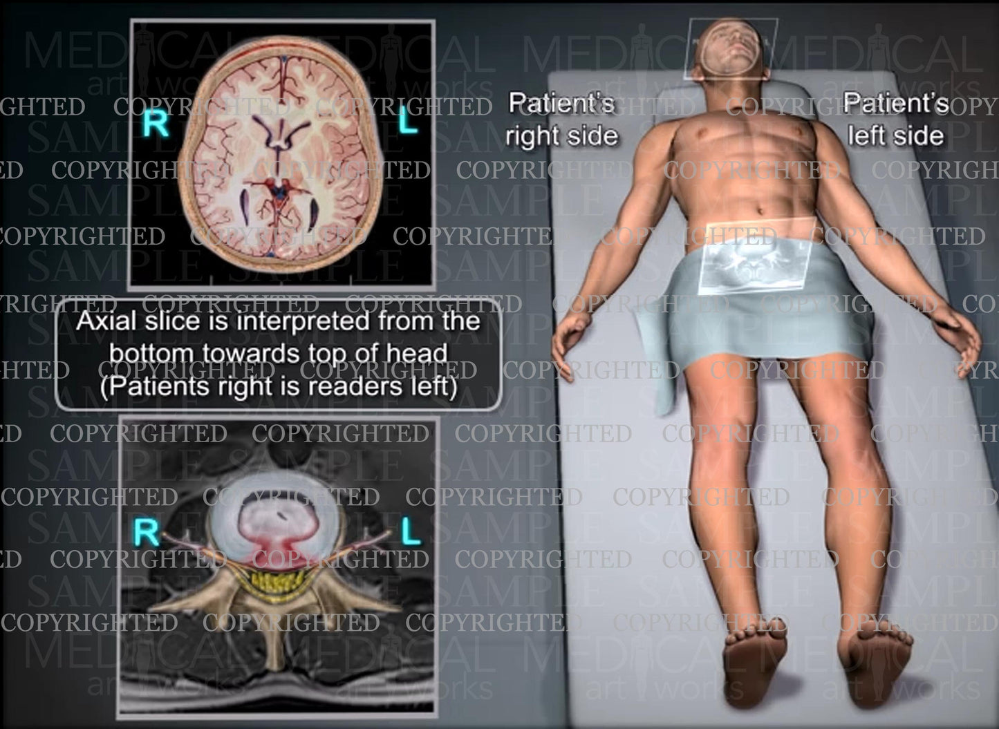 Understanding patient orientation on a MRI or CT scan - Radiology view