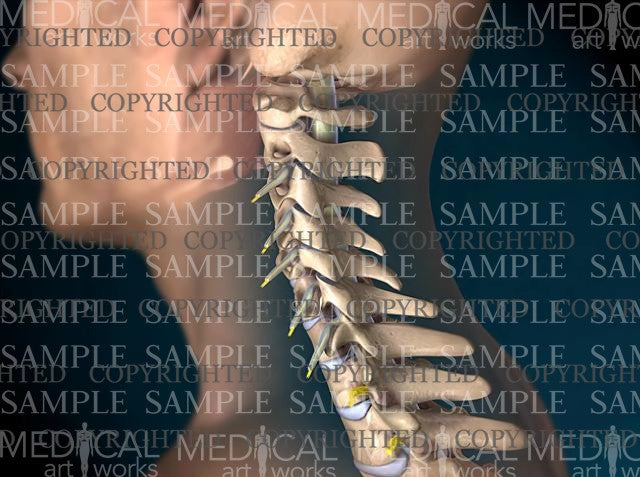 Male cervical spine normal anatomy
