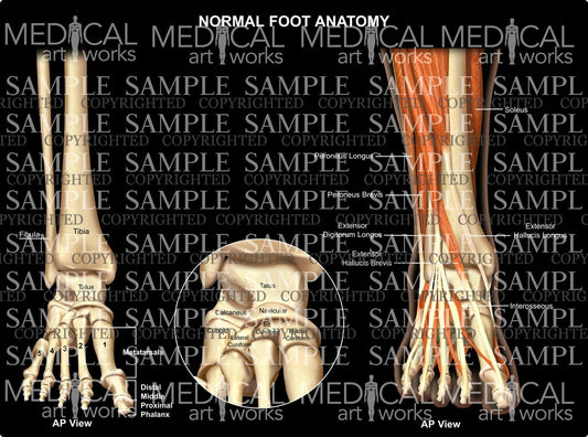 Normal foot anatomy - Right front view