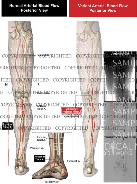 Posteior leg blood flow