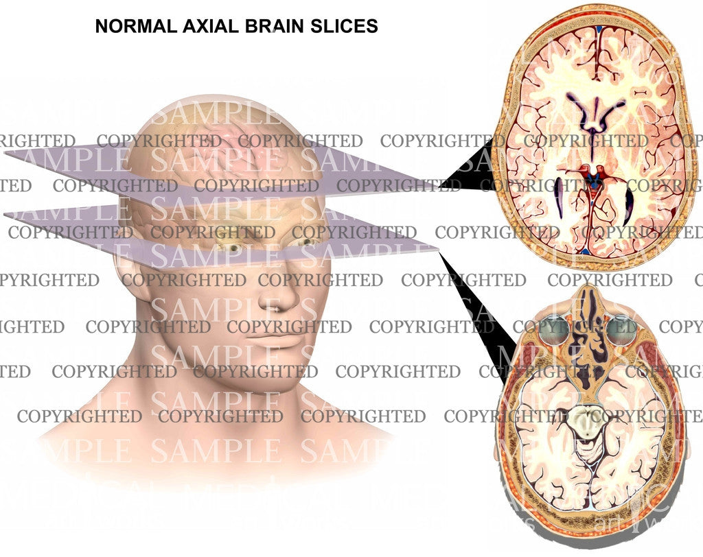 Normal brain anatomy-axial views