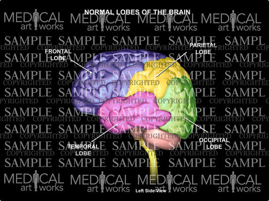 Normal lobes of the Brain