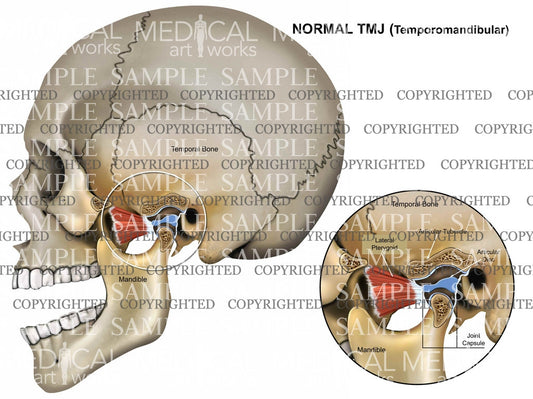 Normal TMJ (Temporomandibular)