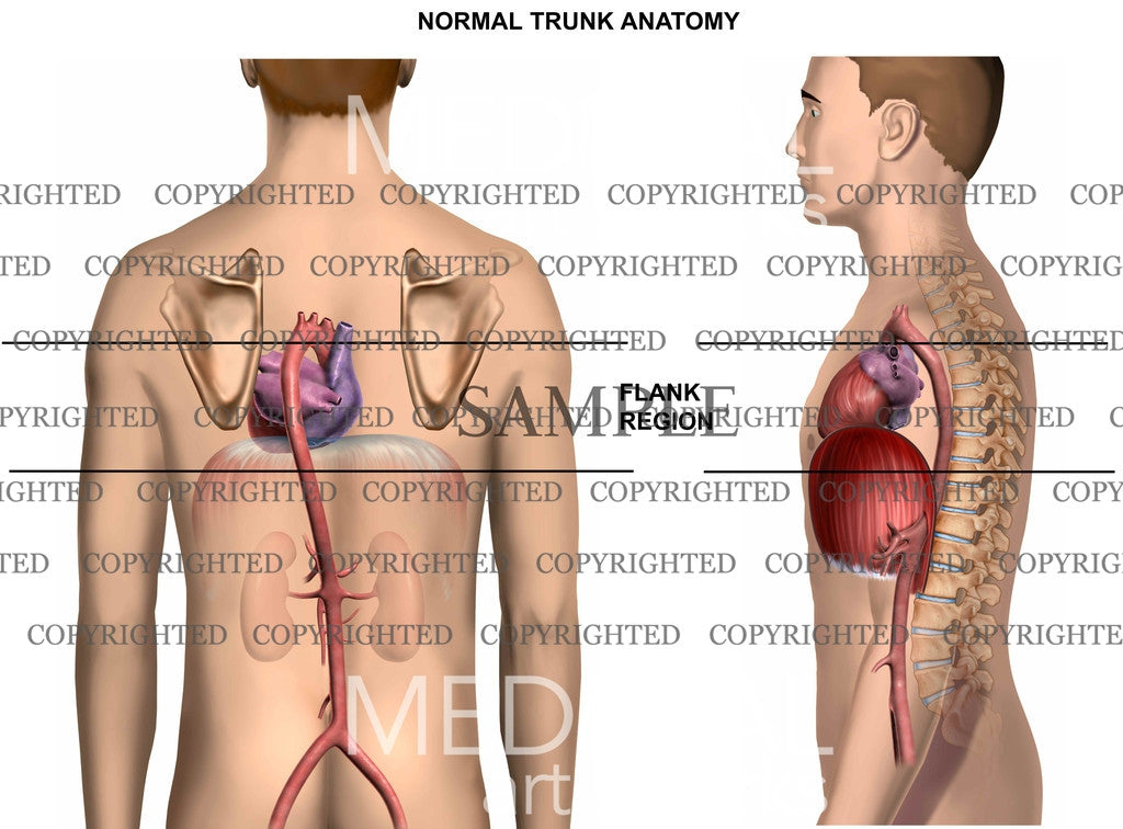 Flank Region of the Anatomy - Trial Exhibits Inc.