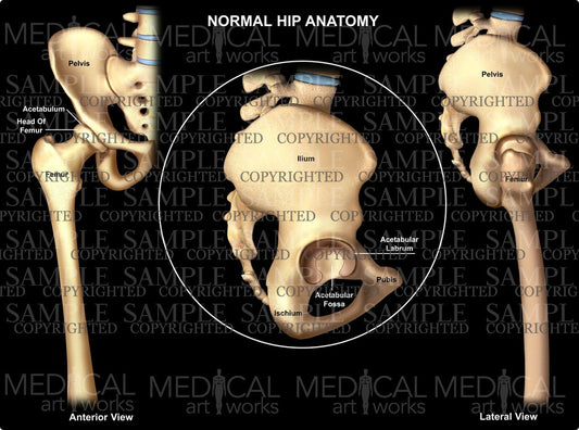 Normal Hip Skeletal Anatomy