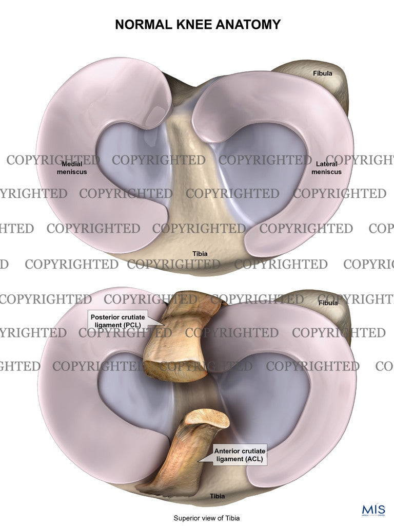 Medial and Lateral Meniscus 1