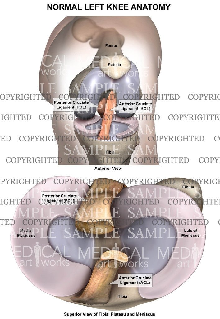 Normal Left Knee Anatomy - Anterior bent knee - Supeior tibial plateau