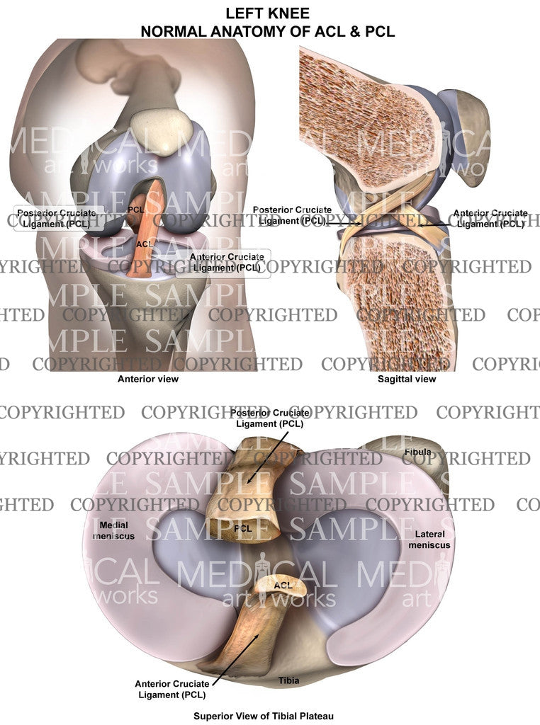 Normal Left Knee Anatomy - Superior tibial plateau, sagittal & anterior view