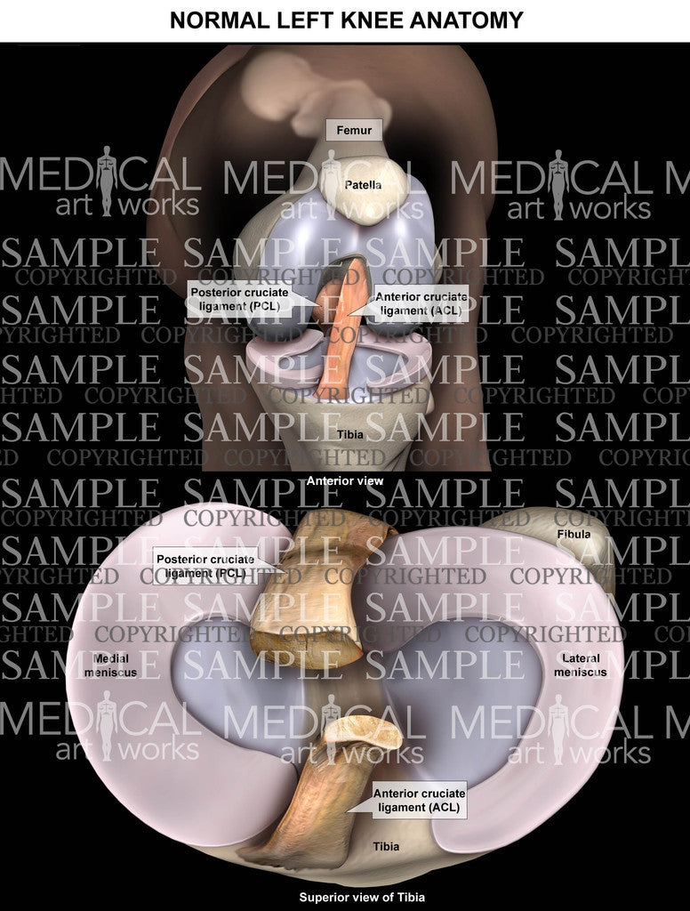 Normal Left Knee Anatomy - Anterior bent knee - Supeior tibial plateau - Meniscus