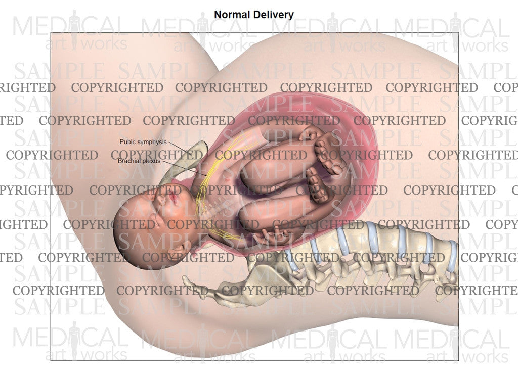 Left normal birth