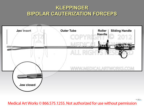 Kleppinger bipolar cauterization forceps