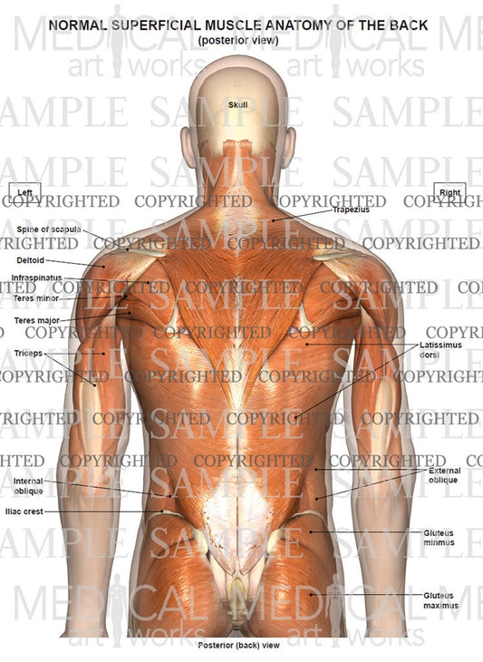 Normal anatomy of the superficial muscles of the back and neck