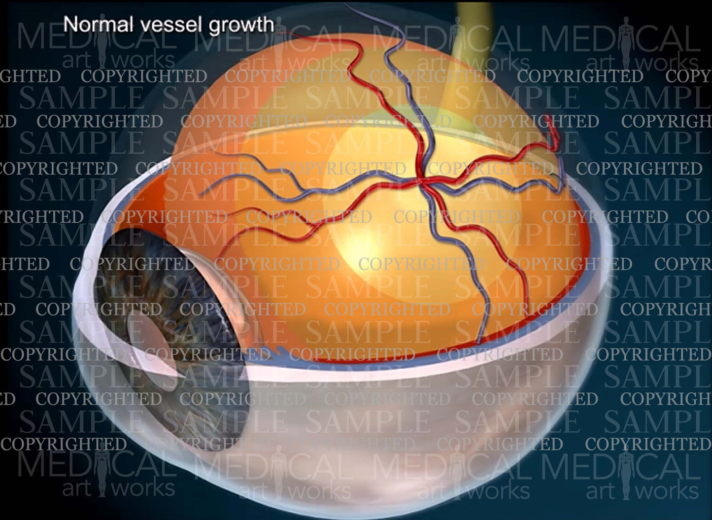 Anatomy of a normal eye - zones - vessel growth