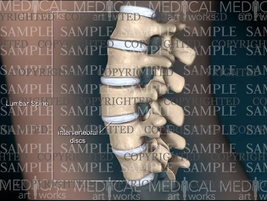 Female lumbar spine normal anatomy