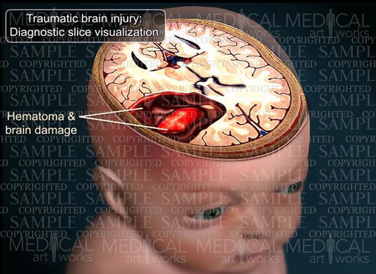 Traumatic brain injury - Diagnostic slice visualization