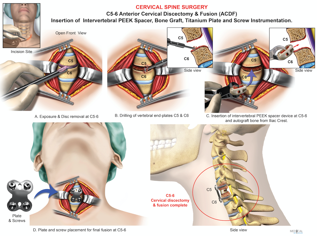 Anterior Cervical Region anterior-cervical-region