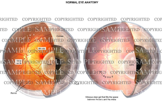 Normal eye anatomy