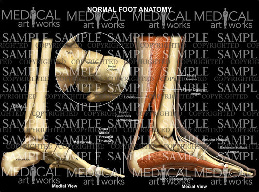 Normal Foot Anatomy medial view