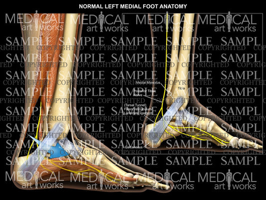 Left foot normal anatomy - medial view