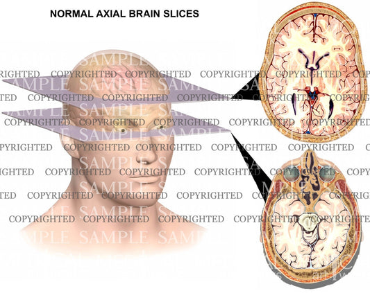 Normal brain anatomy-axial views