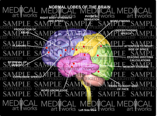 Normal 4 lobes of the Brain