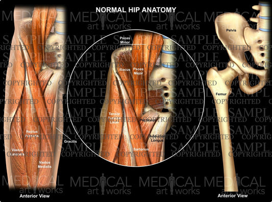 Normal hip anatomy - anterior view