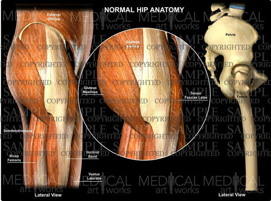 Normal Hip Anatomy Lateral view