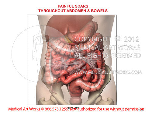 Normal female anatomy of the chest (thoracic) cavity