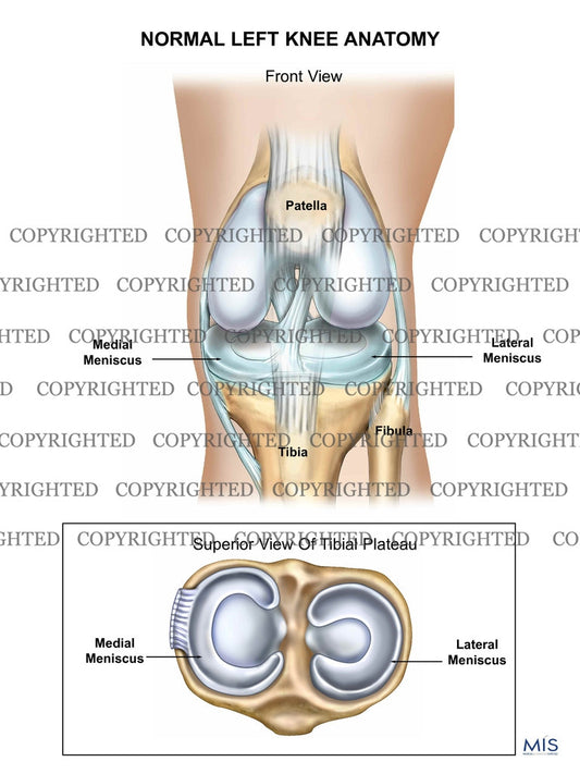 Normal Left Knee Anatomy