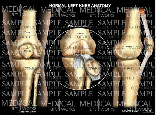 Normal Left Knee Anatomy 6