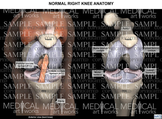 Normal Right Knee Anatomy - Anterior view of bent knee - Black back