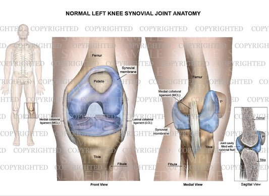 Normal left knee synovial joint anatomy - Collateral ligaments - Male