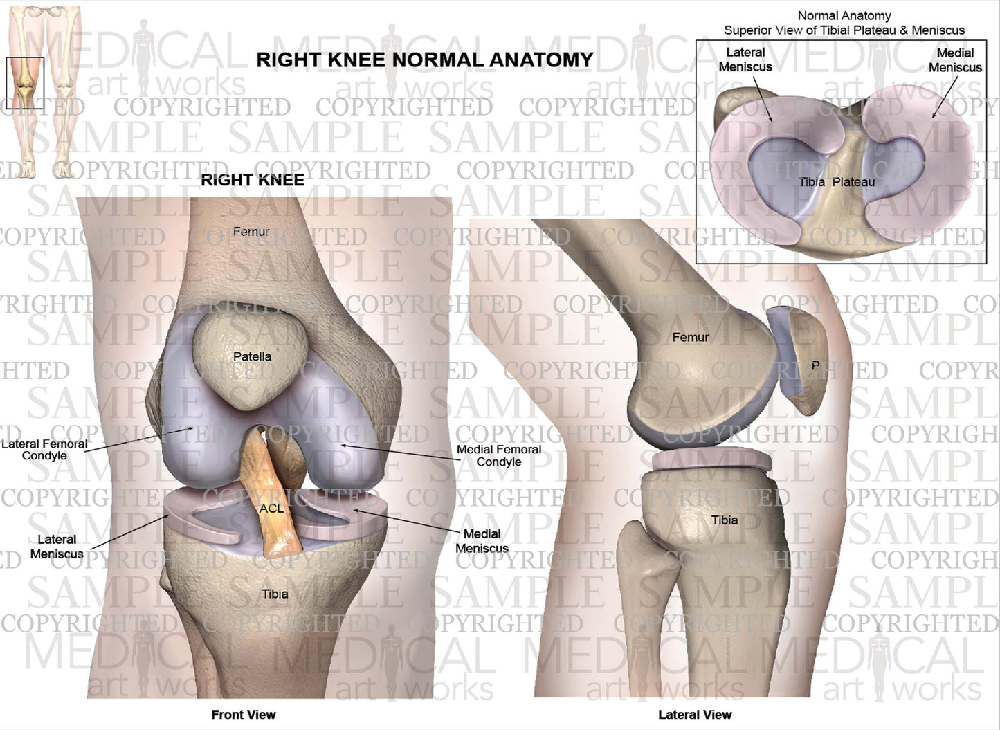 Normal Right Knee Anatomy & Meniscus - Different views