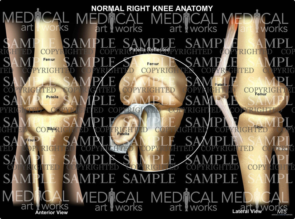 Right Rear Knee Assembly Normal Right Knee Anatomy 3 – Medical Art Works