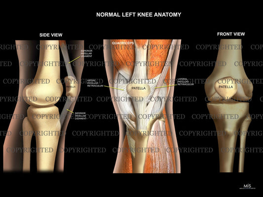 Normal Left Knee Anatomy 5