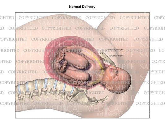 Right normal birth