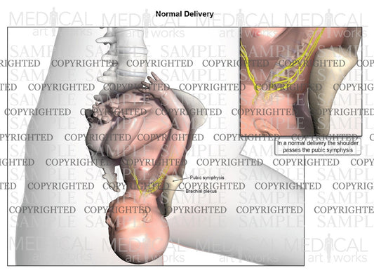 Right normal birth, vertical view