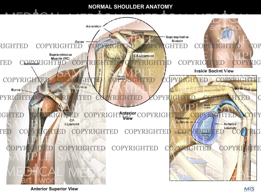 Normal Shoulder Anatomy with Socket view